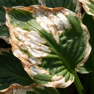 Queimadura Solar (Escaldadura)